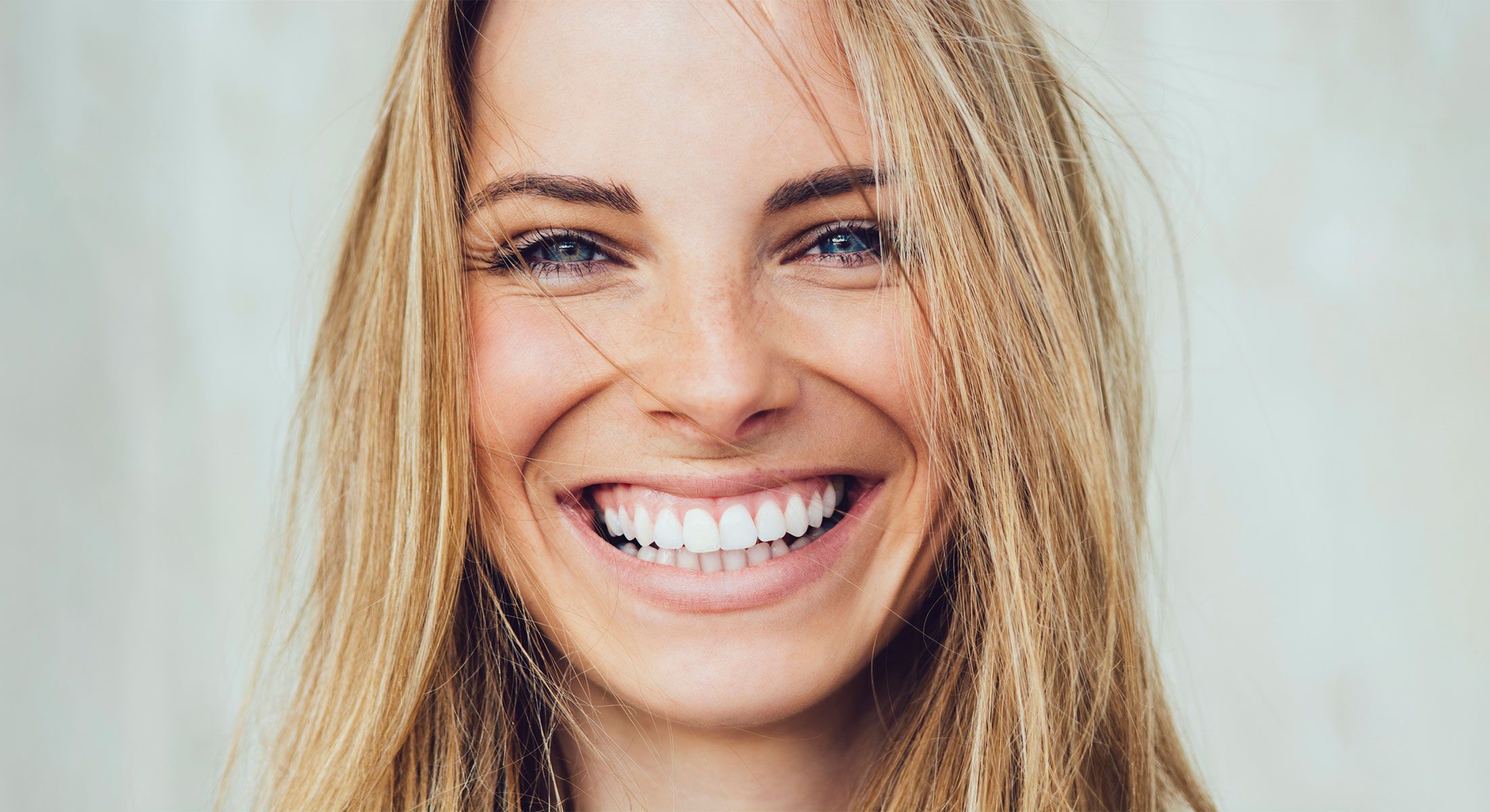 Newport Beach Bioclear Model Smiling